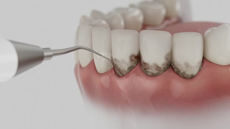 Reliable Emergency Dentist contractor in Clayton, CA by Smile Center Dentistry